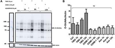 The modulation of the hexosamine biosynthetic pathway impacts the localization of CD36 in macrophages